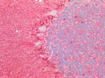 S100B Antibody in Immunohistochemistry (Paraffin) (IHC (P))