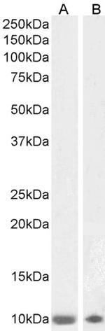 S100B Antibody in Western Blot (WB)