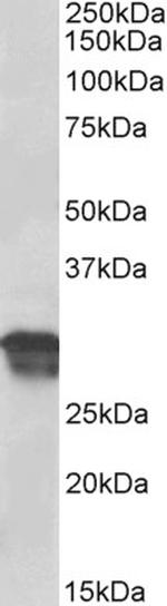 Cyclin D1 Antibody in Western Blot (WB)