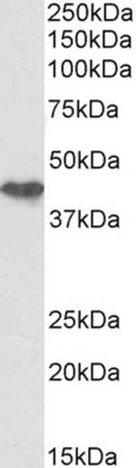 Cytokeratin 19 Antibody in Western Blot (WB)