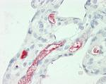 A2M Antibody in Immunohistochemistry (Paraffin) (IHC (P))