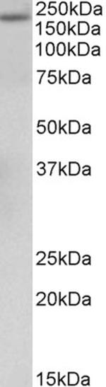 A2M Antibody in Western Blot (WB)