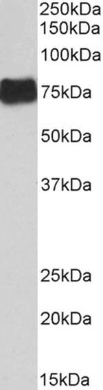 Fibrinogen alpha chain Antibody in Western Blot (WB)