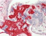 FIBB Antibody in Immunohistochemistry (Paraffin) (IHC (P))