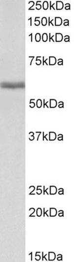 FIBB Antibody in Western Blot (WB)