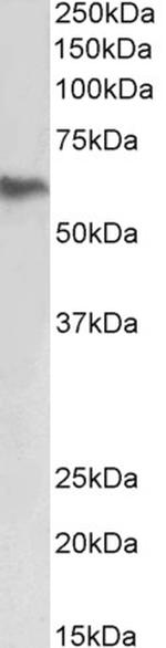 FIBB Antibody in Western Blot (WB)