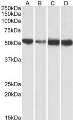 ATP5A1 Antibody in Western Blot (WB)