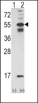 CaMKII alpha Antibody in Western Blot (WB)