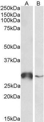 GST Omega 1 Antibody in Western Blot (WB)