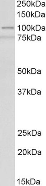 alpha Actinin 1 Antibody in Western Blot (WB)