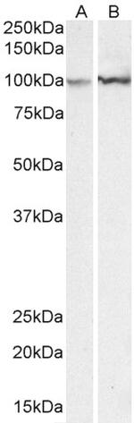 alpha Actinin 1 Antibody in Western Blot (WB)