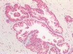 BMI-1 Antibody in Immunohistochemistry (Paraffin) (IHC (P))