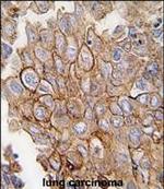 Annexin A2 Antibody in Immunohistochemistry (Paraffin) (IHC (P))