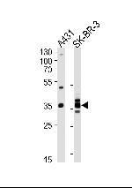 Annexin A2 Antibody in Western Blot (WB)