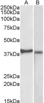 CX3CR1 Antibody in Western Blot (WB)