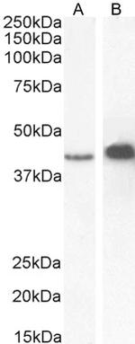 AMACR Antibody in Western Blot (WB)