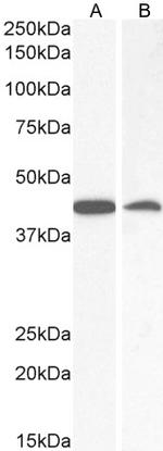 AMACR Antibody in Western Blot (WB)