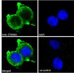 beta Catenin Antibody in Immunocytochemistry (ICC/IF)