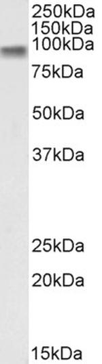 beta Catenin Antibody in Western Blot (WB)