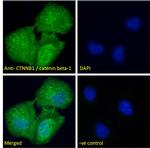 beta Catenin Antibody in Immunocytochemistry (ICC/IF)