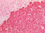 beta Catenin Antibody in Immunohistochemistry (Paraffin) (IHC (P))