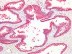 beta Catenin Antibody in Immunohistochemistry (Paraffin) (IHC (P))