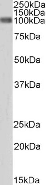 beta Catenin Antibody in Western Blot (WB)