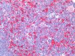 CD74 Antibody in Immunohistochemistry (Paraffin) (IHC (P))