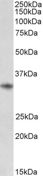 CD74 Antibody in Western Blot (WB)