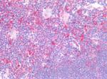 CD74 Antibody in Immunohistochemistry (Paraffin) (IHC (P))