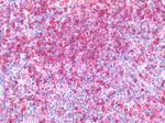 CD74 Antibody in Immunohistochemistry (Paraffin) (IHC (P))