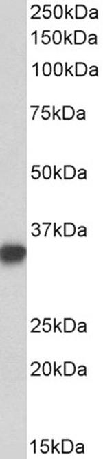 CD74 Antibody in Western Blot (WB)