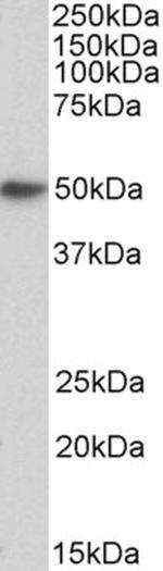 FceR1 alpha Antibody in Western Blot (WB)