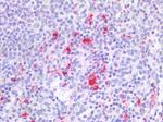 CD18 Antibody in Immunohistochemistry (Paraffin) (IHC (P))