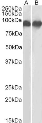 CD18 Antibody in Western Blot (WB)