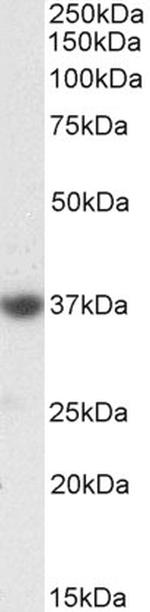 SOX2 Antibody in Western Blot (WB)