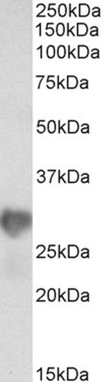 NNMT Antibody in Western Blot (WB)