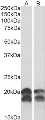 NME1 Antibody in Western Blot (WB)