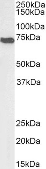 AIF Antibody in Western Blot (WB)