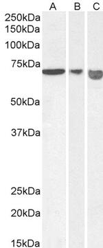 AIF Antibody in Western Blot (WB)