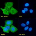 AMHR2 Antibody in Immunocytochemistry (ICC/IF)