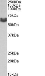 AMHR2 Antibody in Western Blot (WB)