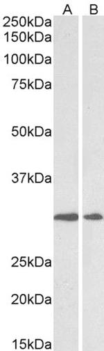 LOX Antibody in Western Blot (WB)