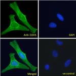 VE-cadherin Antibody in Immunocytochemistry (ICC/IF)