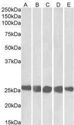 CK2 beta Antibody in Western Blot (WB)