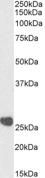 CK2 beta Antibody in Western Blot (WB)