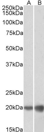 DUT Antibody in Western Blot (WB)