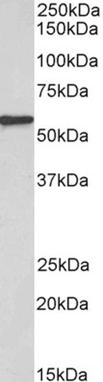 EPHX2 Antibody in Western Blot (WB)