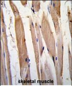 Vinculin Antibody in Immunohistochemistry (Paraffin) (IHC (P))