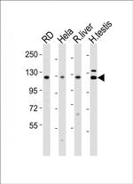 Vinculin Antibody in Western Blot (WB)